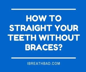straighting teeth without braces