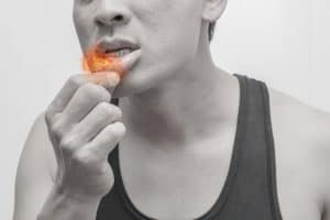 mouth ulcers treatment