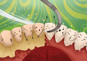remove-plaque-tartar-from-teeth